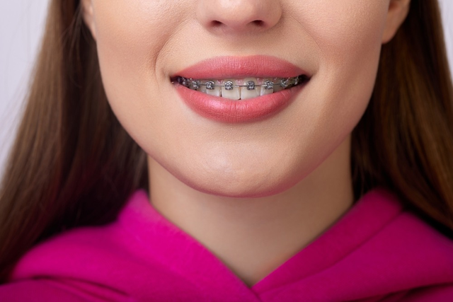 orthodontics in flushing and great neck