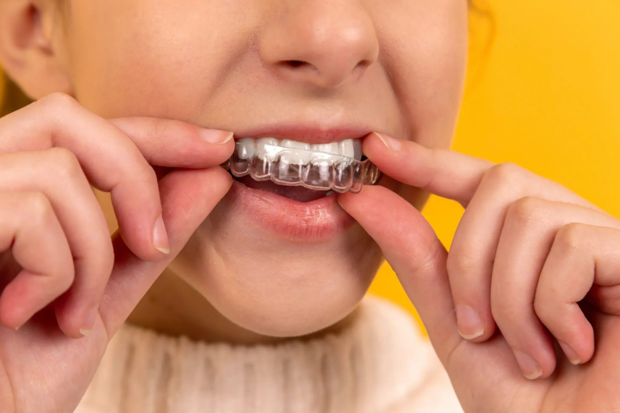why you should wear invisalign 22 hours a day