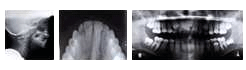 radiographs